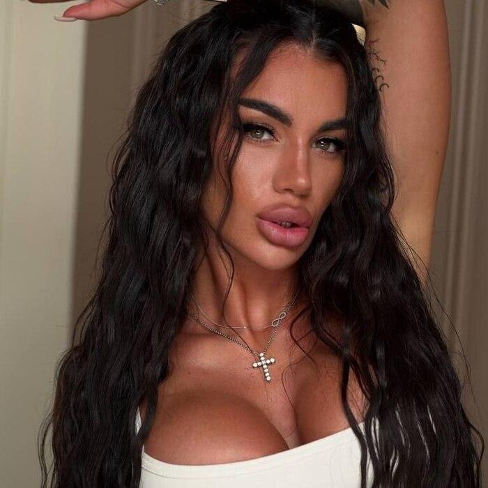 Albina